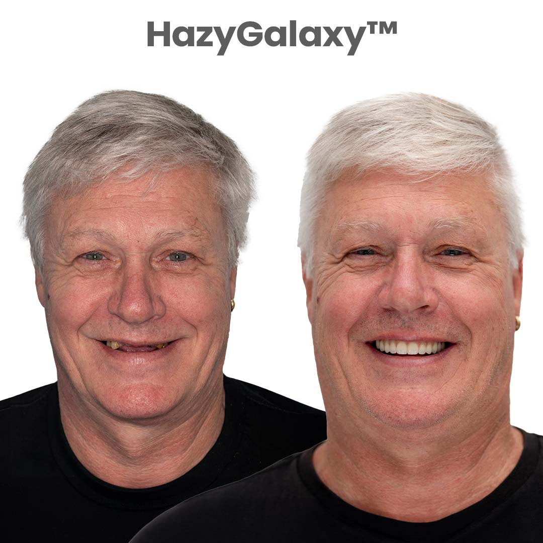 🌎🏆Ends Today: 70% OFF! 🏆2026 Bestselling Product🦷 Fit for a Fresh Smile, Say Goodbye to Wearing Discomfort!